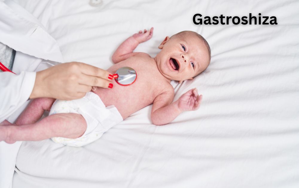 Understanding Gastroshiza: A Gentle and Informative Guide